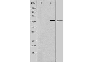 Western blot analysis of extracts from HeLa cells, using ARPP21 antibody.