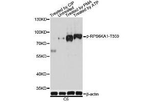 Western blot analysis of extracts of C6 cells, using Phospho-RPS6KA1-T359 antibody. (RPS6KA1 antibody  (pSer363))