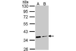 Western Blotting (WB) image for anti-Aspartoacylase (ASPA) antibody (ABIN2856897)
