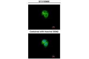 ICC/IF Image Immunofluorescence analysis of methanol-fixed Hep G2, using Adenylate kinase 7, antibody at 1:500 dilution. (Adenylate Kinase 7 antibody)