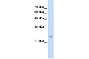 WB Suggested Anti-CHIC1 Antibody Titration:  5.