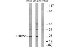 Western blot analysis of extracts from HuvEc/COLO cells, using ERD22 Antibody.