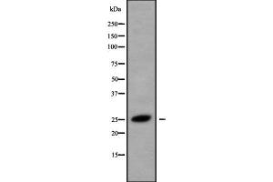 Western blot analysis of CMTM5 using HeLa whole cell lysates (CMTM5 antibody  (Internal Region))