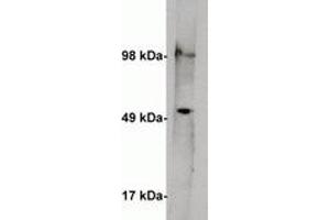 Image no. 1 for anti-serine Palmitoyltransferase, Long Chain Base Subunit 1 (SPTLC1) antibody (ABIN201813) (SPTLC1 antibody)