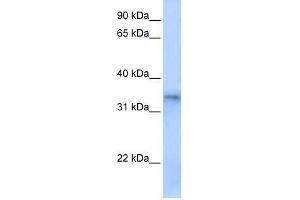 FHL5 antibody used at 0. (FHL5 antibody  (Middle Region))