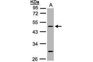 WB Image Sample(30 ug whole cell lysate) A:HeLa S3, 10% SDS PAGE antibody diluted at 1:1000 (KRT20 antibody  (C-Term))