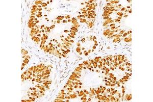 IHC staining of normal colon with p53 antibody cocktail (BP53-12 + DO-7). (p53 antibody)