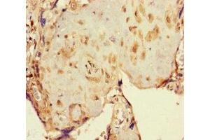 Immunohistochemistry of paraffin-embedded human placenta tissue using ABIN7162411 at dilution of 1:100