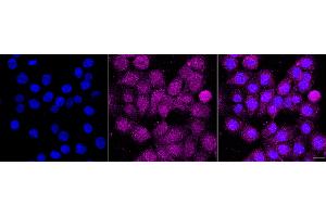 Immunocytochemical staining of HT- cells with PLEKHA1 antibody(ABIN7799851), 1:1,000).