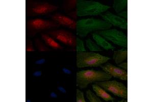 ABIN6256975 and ABIN6275033 staining  cells by IF/ICC. (C1QBP antibody  (Internal Region))