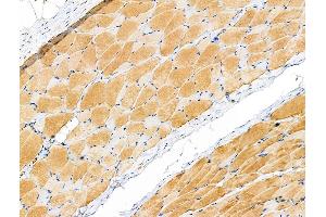 Phospho-PYGL (Ser15) Antibody at 1/100 staining Rat ovarian tissue by IHC-P.