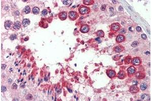 Testis, Human: Formalin-Fixed, Paraffin-Embedded (FFPE) (Reticulon 4 antibody  (AA 501-515))