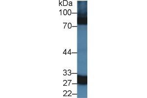 Western Blot; Sample: Rat Spleen lysate; Primary Ab: 1. (CA5A antibody  (AA 12-219))