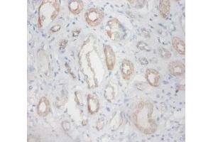 Immunohistochemistry of paraffin-embedded human kidney tissue using ABIN7176559 at dilution of 1:100 (ZFP91 antibody  (AA 1-208))
