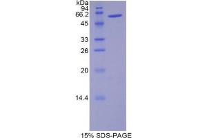 SDS-PAGE analysis of Rat Noggin Protein.