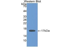 Detection of Recombinant IL2, Human using Monoclonal Antibody to Interleukin 2 (IL2) (IL-2 antibody  (AA 21-153))
