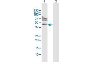 Western Blot analysis of FOXP3 expression in transfected 293T cell line by FOXP3 MaxPab polyclonal antibody. (FOXP3 antibody  (AA 1-431))