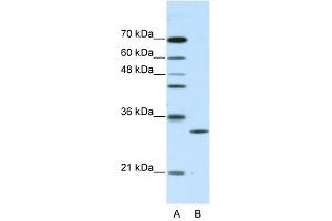 CLIC1 antibody used at 2. (CLIC1 antibody  (C-Term))