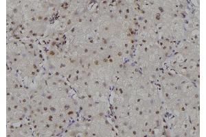 Immunohistochemistry (IHC) image for anti-Replication Protein A2, 32kDa (RPA2) (N-Term) antibody (ABIN6264708)