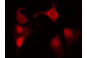 ABIN6274141 staining COLO205 cells by IF/ICC. (ZNF682 antibody  (N-Term))
