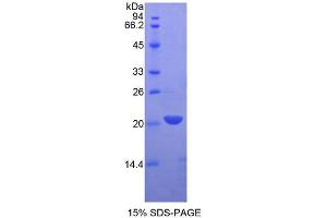 SDS-PAGE analysis of Rat LECT2 Protein. (LECT2 Protein)