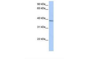 Image no. 1 for anti-Acyl-CoA Dehydrogenase, Short/branched Chain (ACADSB) (AA 254-303) antibody (ABIN6738960) (ACADSB antibody  (AA 254-303))