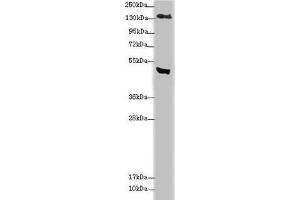 Western blot All lanes: MTUS1 antibody at 3. (MTUS1 antibody  (AA 1041-1270))