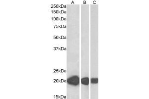CSRP3 antibody  (Internal Region)
