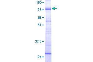 SLC22A7 Protein (AA 1-548) (GST tag)