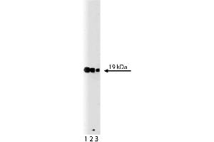 Western blot analysis of p19 [Skp1] on a A431 lysate.