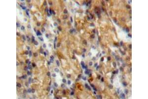 Used in DAB staining on fromalin fixed paraffin-embedded kidney tissue (SLIT3 antibody  (AA 454-498))