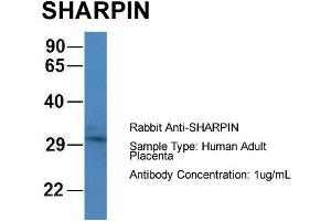 Host: Rabbit Target Name: CHAD Sample Type: Human Adult Placenta Antibody Dilution: 1. (SHARPIN antibody  (C-Term))
