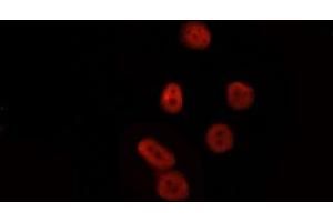 ABIN6277777 staining HepG2 by IF/ICC. (LEF1 antibody  (Internal Region))