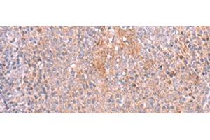 Immunohistochemistry of paraffin-embedded Human tonsil tissue using ZSWIM1 Polyclonal Antibody at dilution of 1:55(x200) (ZSWIM1 antibody)