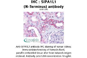 Image no. 1 for anti-Signal-Induced Proliferation-Associated 1 Like 1 (SIPA1L1) (N-Term) antibody (ABIN1739266) (SIPA1L1 antibody  (N-Term))