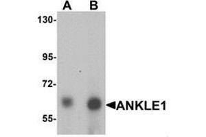 Western blot analysis of ANKLE1 in 293 cell lysate with ANKLE1 antibody at (A) 1 and (B) 2 ug/mL. (ANKLE1 antibody  (C-Term))