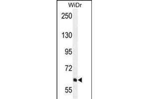 PIK3R5 Antibody (C-term) (ABIN655491 and ABIN2845011) western blot analysis in WiDr cell line lysates (35 μg/lane). (PIK3R5 antibody  (C-Term))