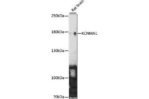 Western blot analysis of extracts of Rat brain, using KCNM antibody (5283) at 1:1000 dilution. (KCNMA1 antibody  (AA 850-950))