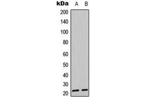 Western blot analysis of BIK (pT33) expression in Jarkat (A), K562 (B) whole cell lysates. (BIK antibody  (N-Term, pSer33))
