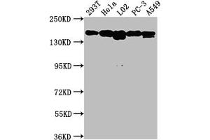 Western Blot Positive WB detected in: 293T whole cell lysate, Hela whole cell lysate, L02 whole cell lysate, PC-3 whole cell lysate, A549 whole cell lysate All lanes: MET antibody at 1:1500 Secondary Goat polyclonal to rabbit IgG at 1/50000 dilution Predicted band size: 156, 158, 86 kDa Observed band size: 156 kDa (Recombinant c-MET antibody)