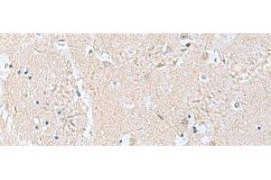 Immunohistochemistry of paraffin-embedded Human brain tissue using TPD52L3 Polyclonal Antibody at dilution of 1:160(x200) (TPD52L3 antibody)