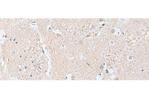 Immunohistochemistry of paraffin-embedded Human brain tissue using TPD52L3 Polyclonal Antibody at dilution of 1:160(x200)