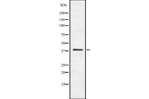 Western blot analysis OBCAM using LOVO whole cell lysates (OPCML antibody  (C-Term))