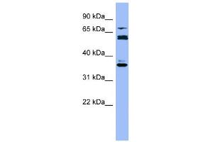 WB Suggested Anti-CYP2B6 Antibody Titration:  0. (CYP2B6 antibody  (Middle Region))