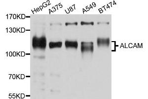 Western blot analysis of extracts of SH-SY5Y cell and HT-1080 cell line, using ALCAM antibody. (CD166 antibody)