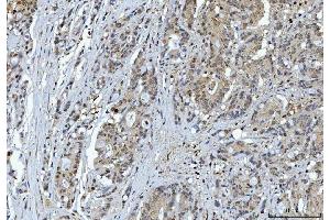 IHC analysis of YWHAE using anti-YWHAE antibody (ABIN7599165). (YWHAE antibody  (AA 1-255))