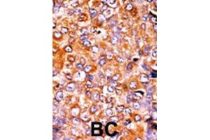 Immunohistochemistry (IHC) image for anti-Myelin Transcription Factor 1 (MYT1) (pThr495) antibody (ABIN3001766)