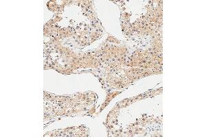 Immunohistochemical analysis of paraffin-embedded Human testis tissue using B performed on the Leica® BOND RXm. (AMHR2 antibody  (N-Term))