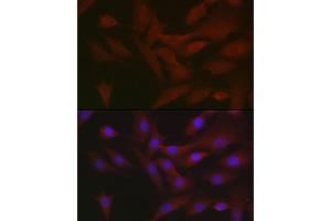 Immunofluorescence analysis of NIH/3T3 cells using RIPK3 Rabbit pAb (ABIN6132598, ABIN6146964, ABIN6146967 and ABIN6221084) at dilution of 1:50 (40x lens). (RIPK3 antibody  (AA 1-120))