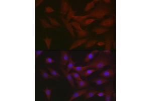 Immunofluorescence analysis of NIH/3T3 cells using RIPK3 Rabbit pAb (ABIN6132598, ABIN6146964, ABIN6146967 and ABIN6221084) at dilution of 1:50 (40x lens). (RIPK3 antibody  (AA 1-120))